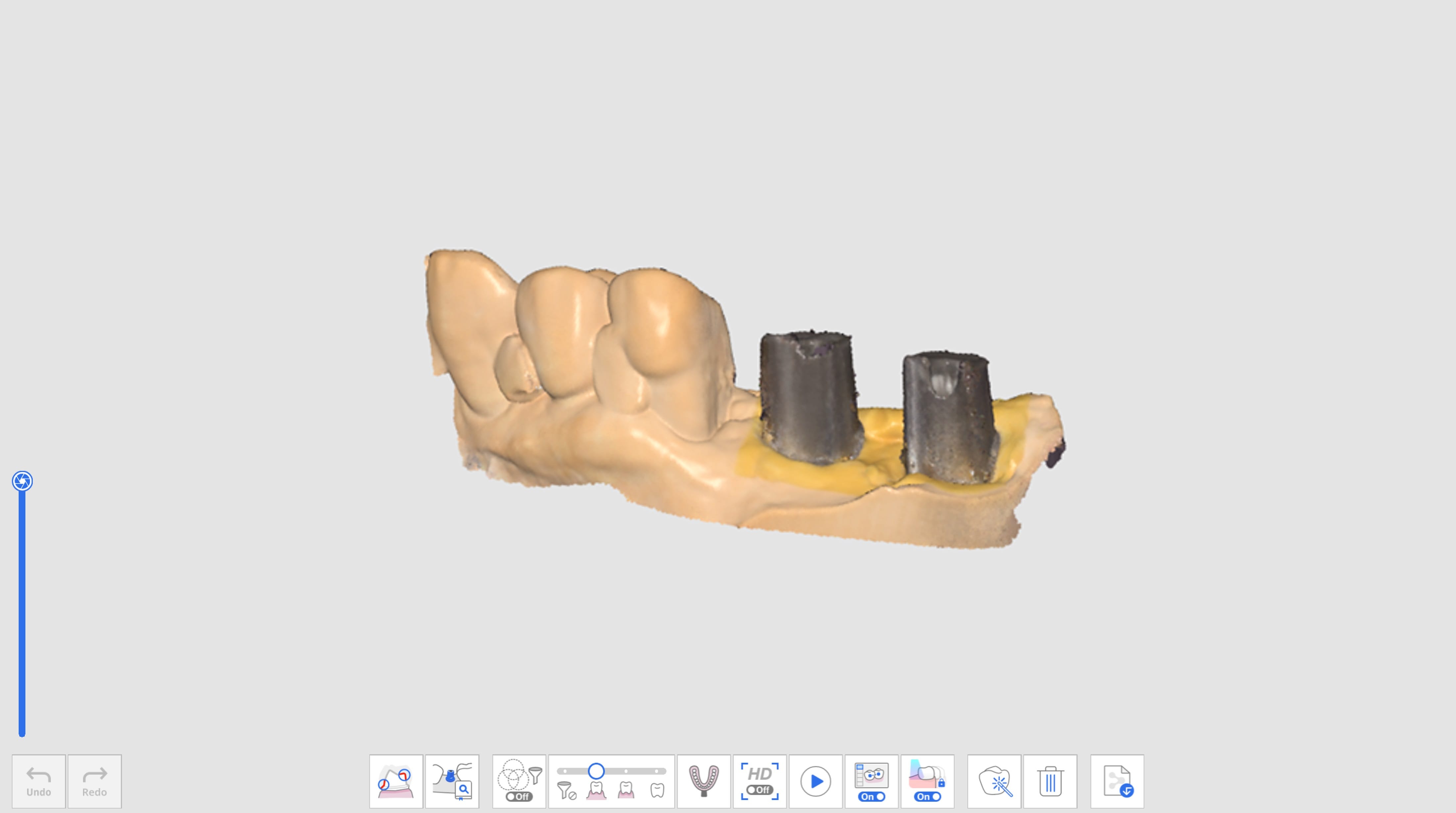 Assign Abutment Library-1.jpg