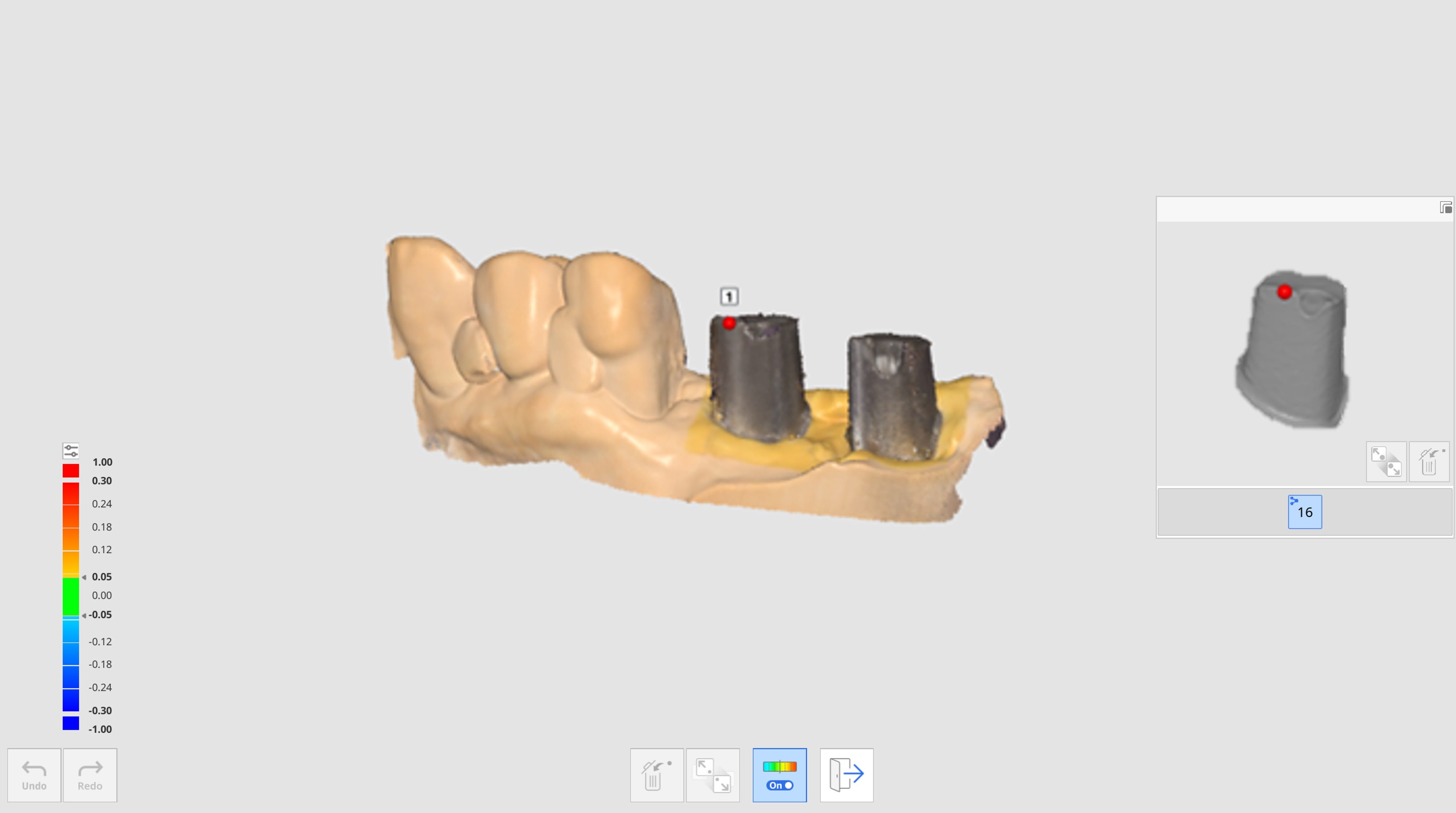 Align Abutment Library-3.jpg