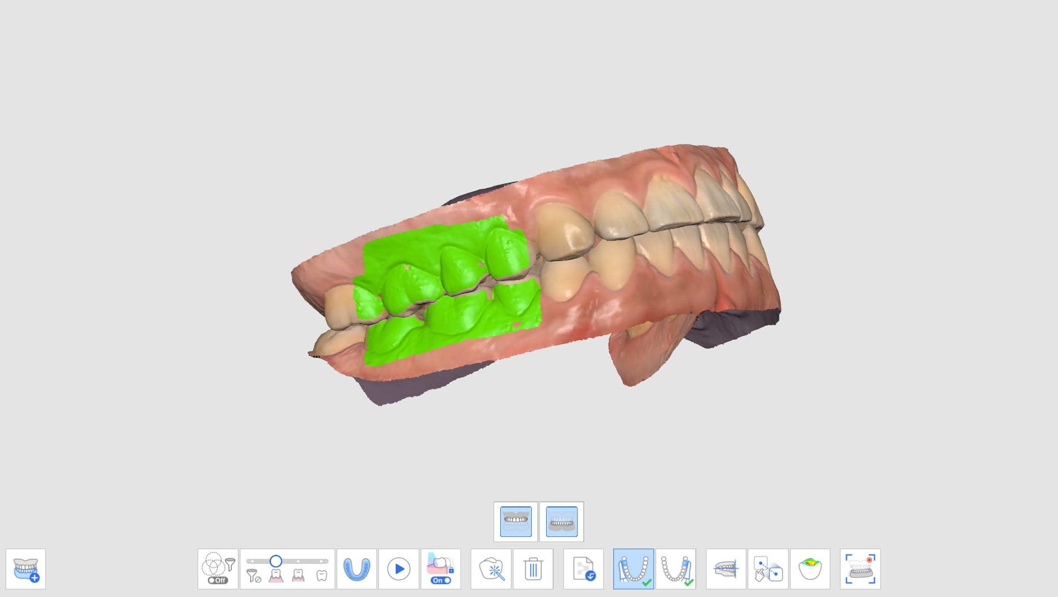 Multi Occlusion-5.jpg