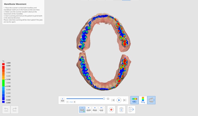 Mandibular Movement-11.jpg