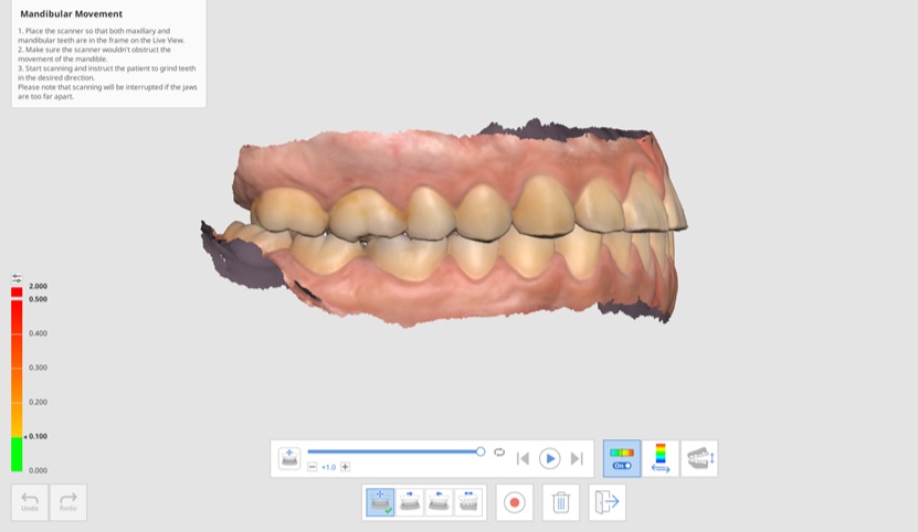 Mandibular Movement-8.jpg