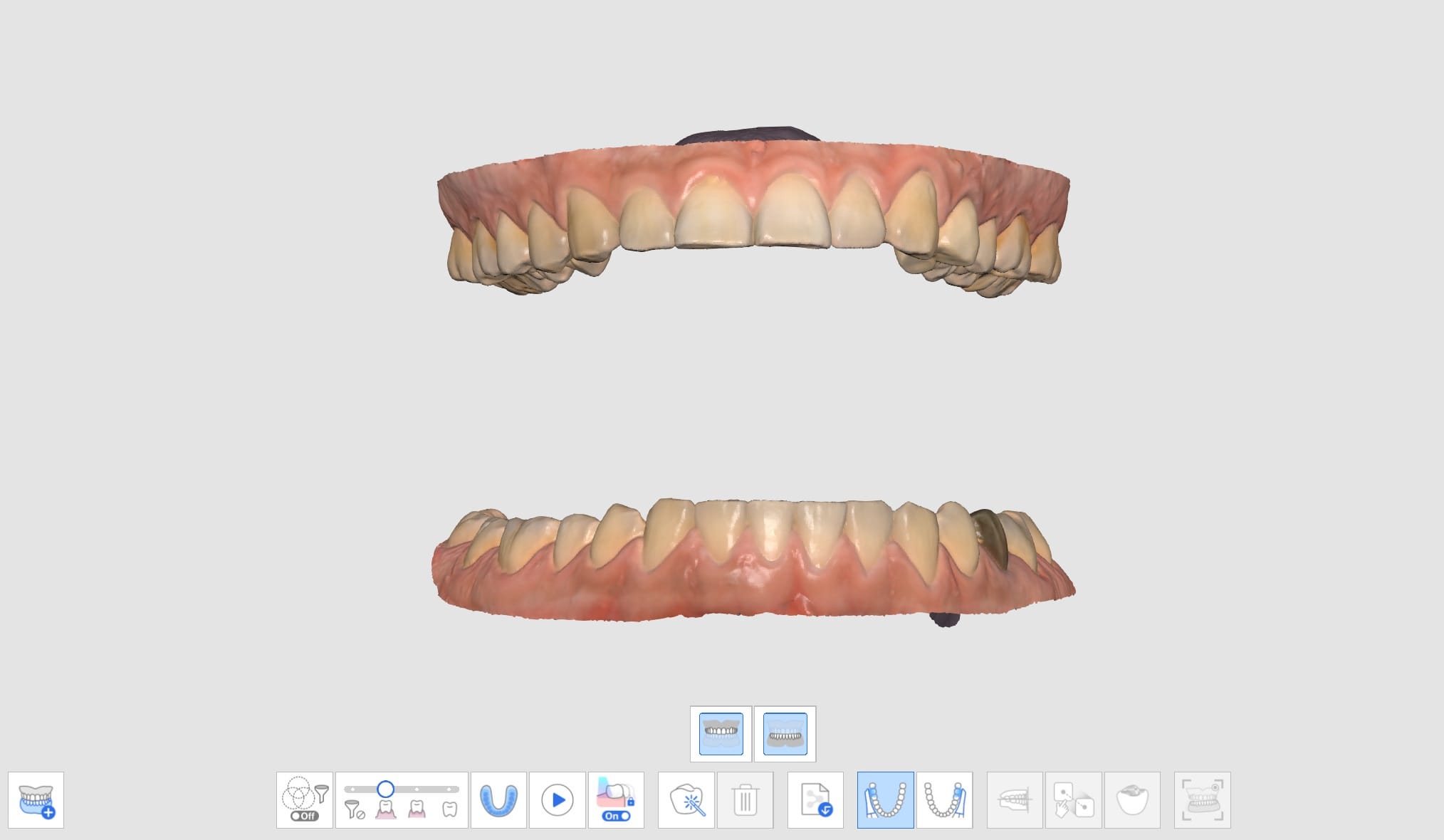 Multi Occlusion-2.jpg