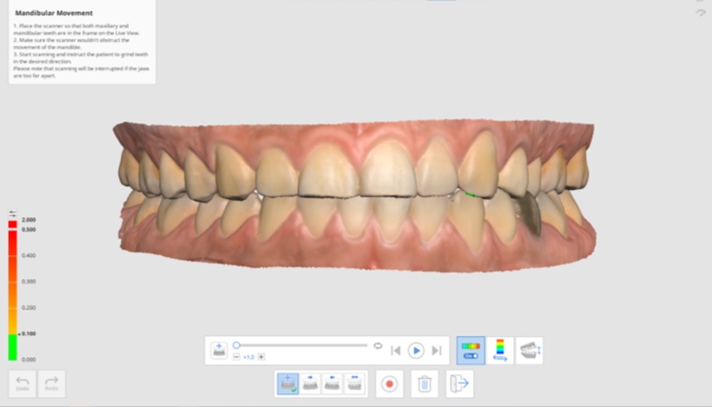 Mandibular Movement-1.jpg