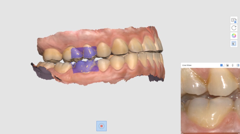 Mandibular Movement-6.jpg