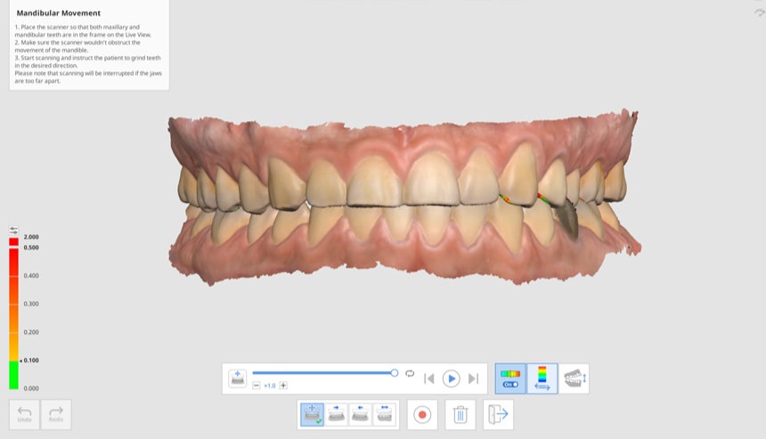 Mandibular Movement-9.jpg