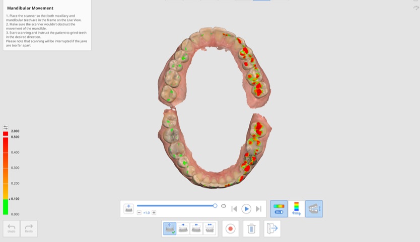 Mandibular Movement-12.jpg
