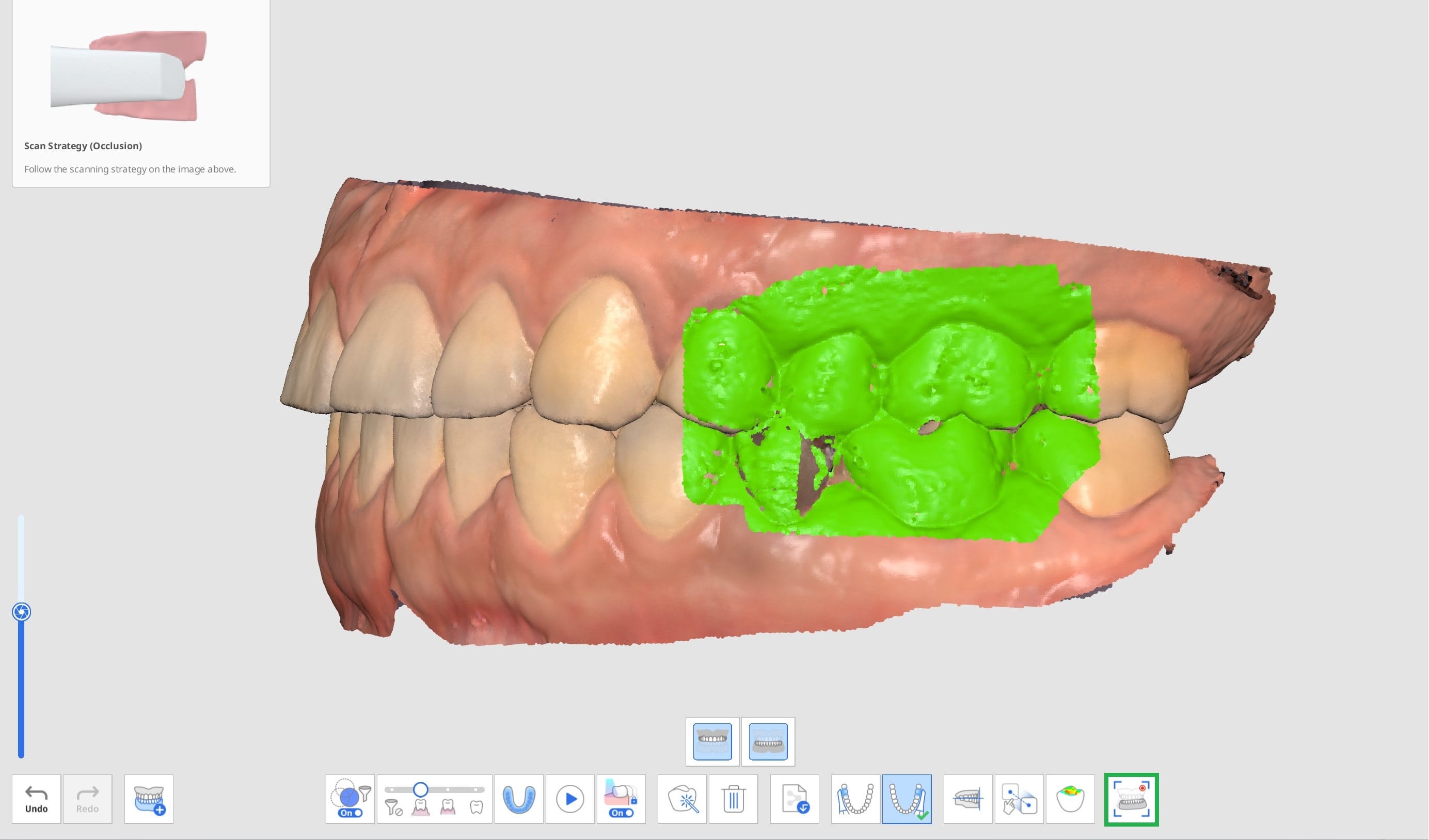 Mandibular Movement 3.jpg