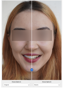 preview_L2.png