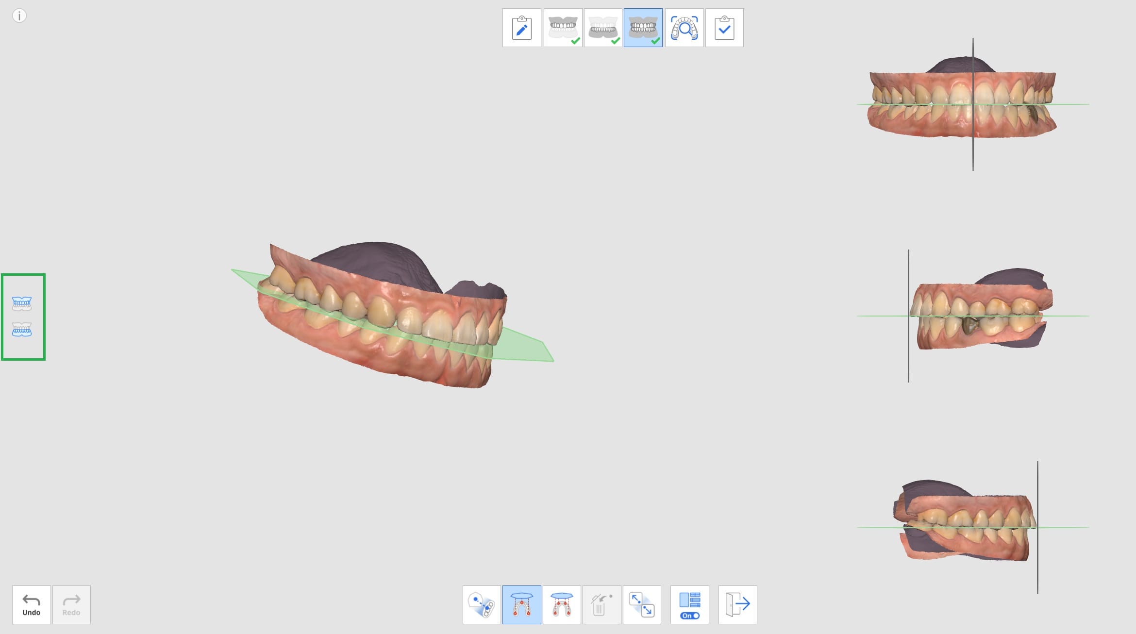 Occlusion Target-5.jpg
