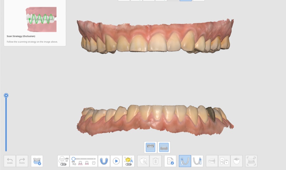 Mandibular Movement-2.jpg