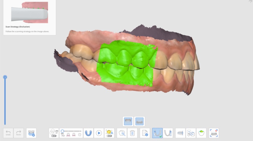 Mandibular Movement-3.jpg