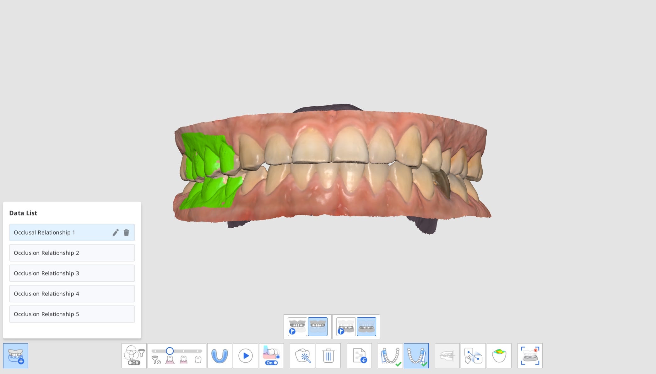 Multi Occlusion-1.jpg