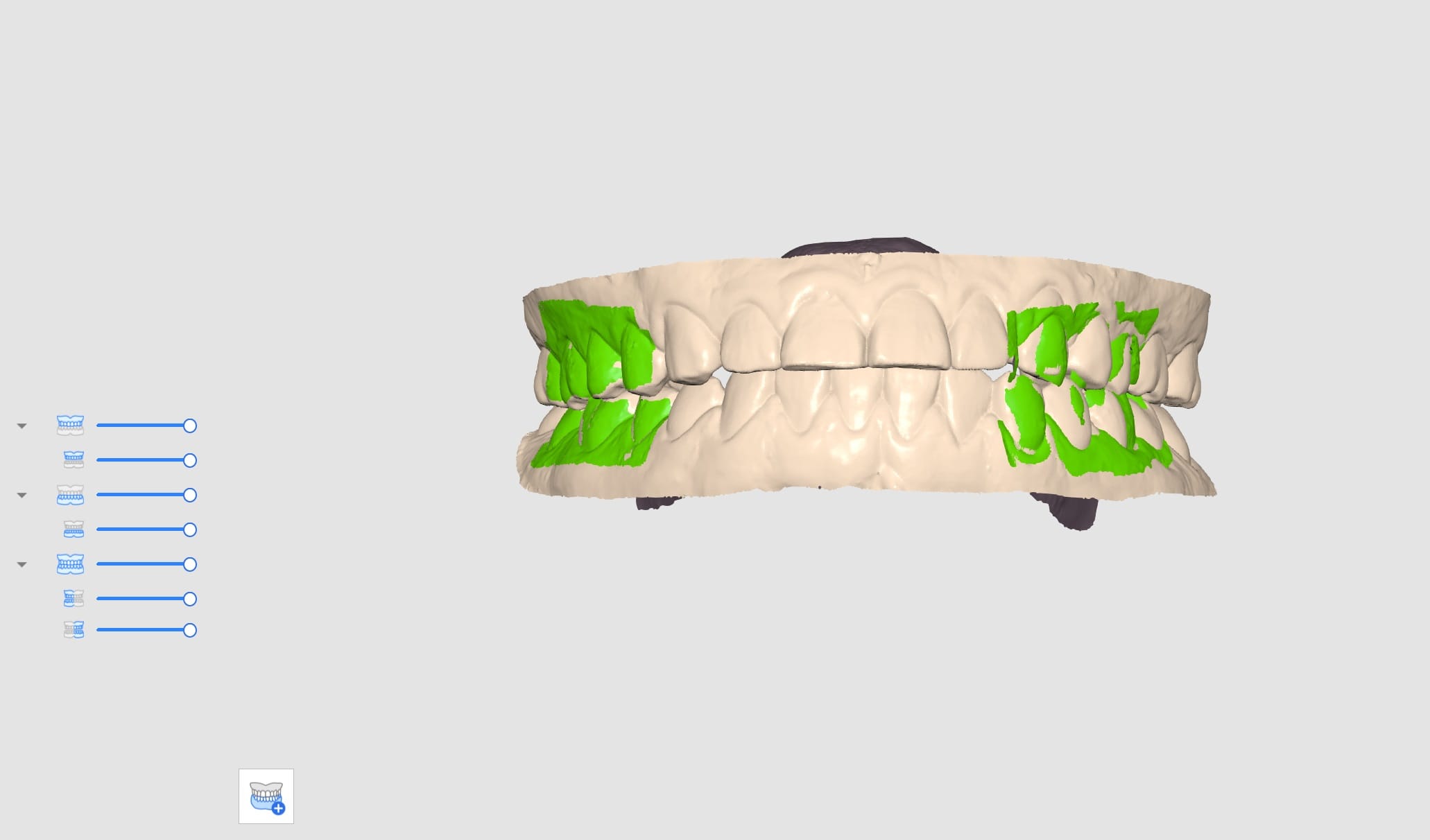 Multi Occlusion-7.jpg