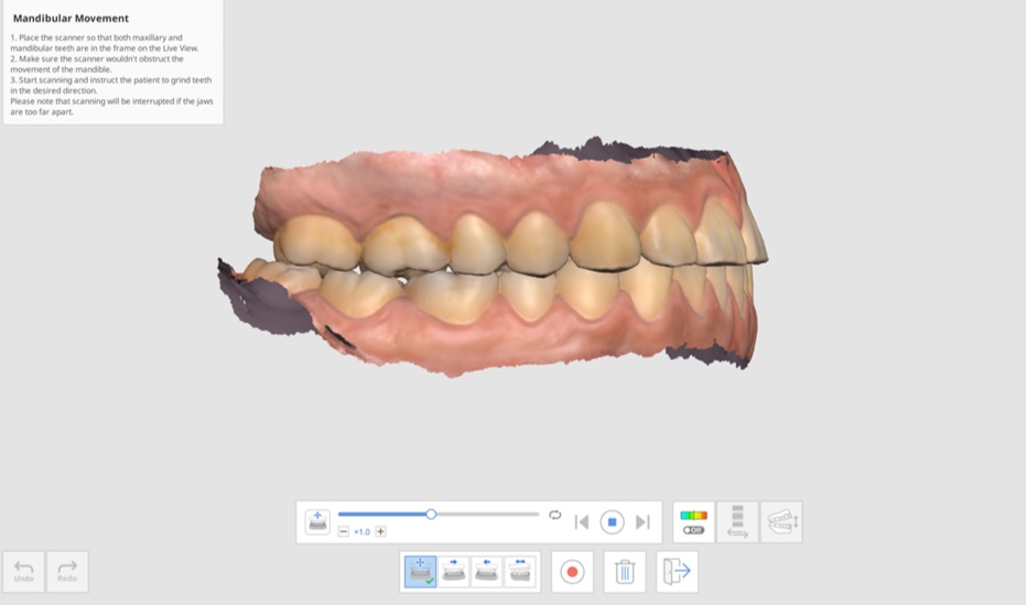Mandibular Movement-7.jpg