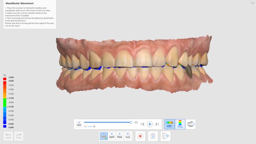 Mandibular Movement-10.jpg