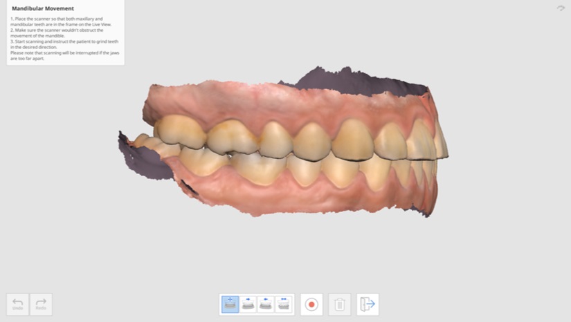 Mandibular Movement-5.jpg