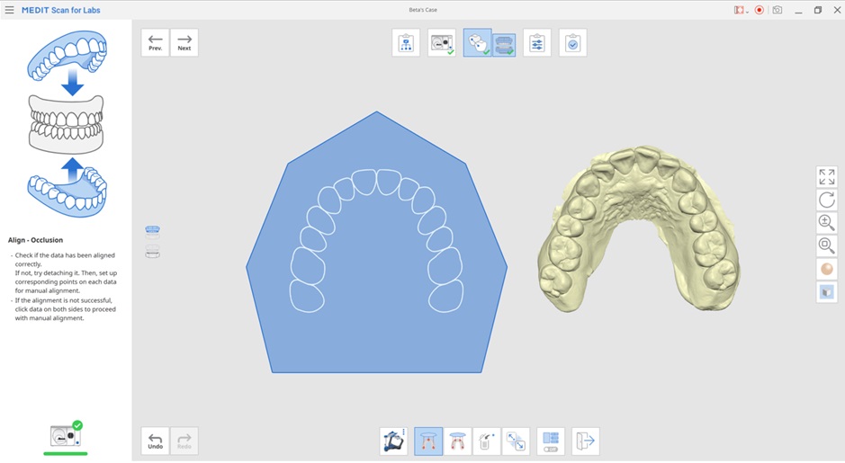Align with Occlusal Plane 4.jpg