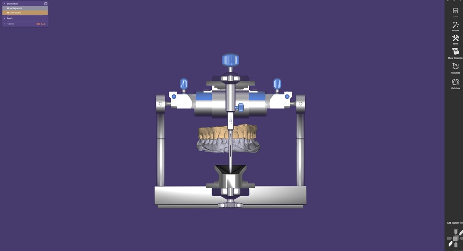 Align with Occlusal Plane 7.jpg
