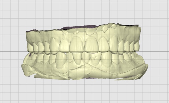 Grid-Settings-Overlay-On-1.jpg