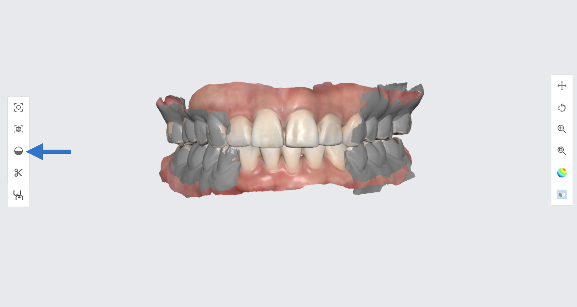 2.5.7_fill_holes.png