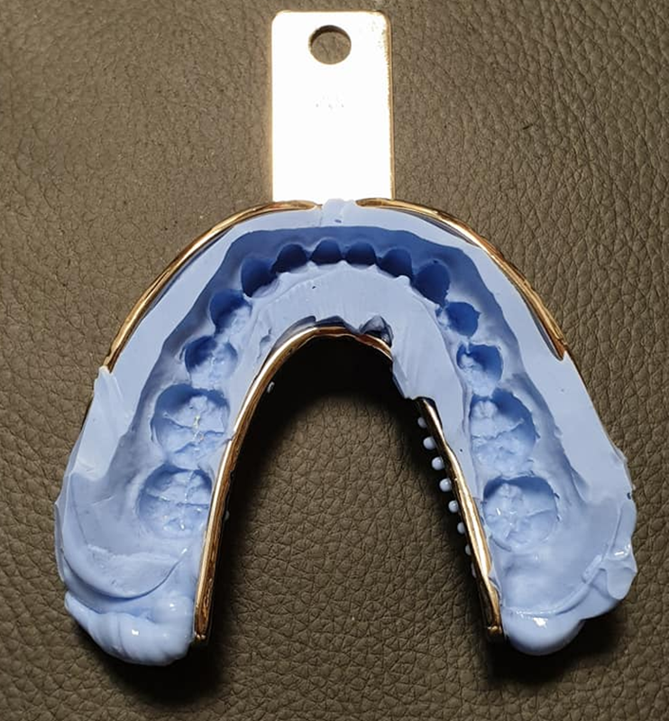 1_anterior.png