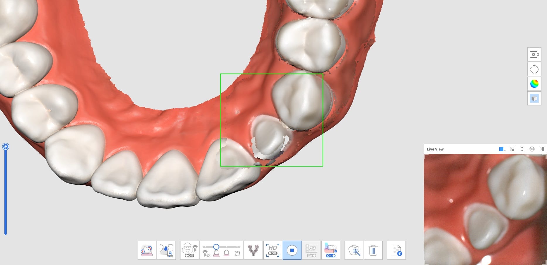 How to Utilize Pre-Op Scan-3.jpg
