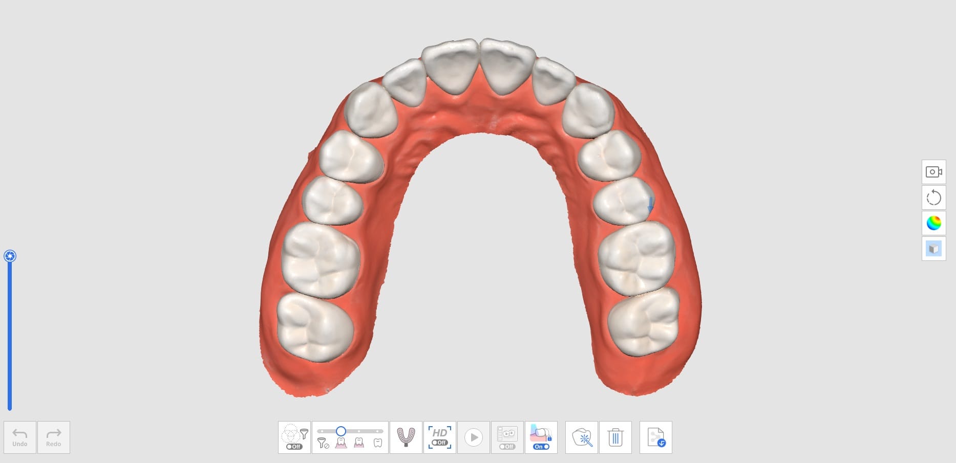 How to Utilize Pre-Op Scan With Trimming Tools-2.jpg