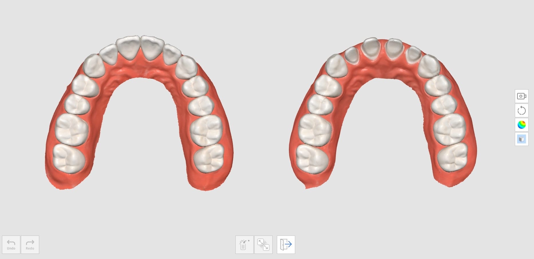 How to Delete Replicated Pre-Op Scan and Scan New Data-7.jpg