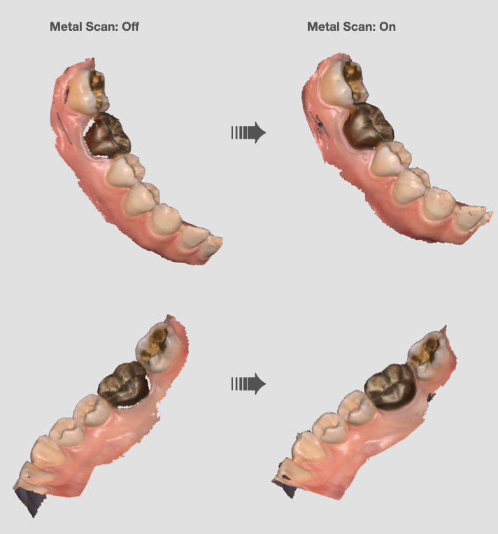 metal_scan_comparison.png