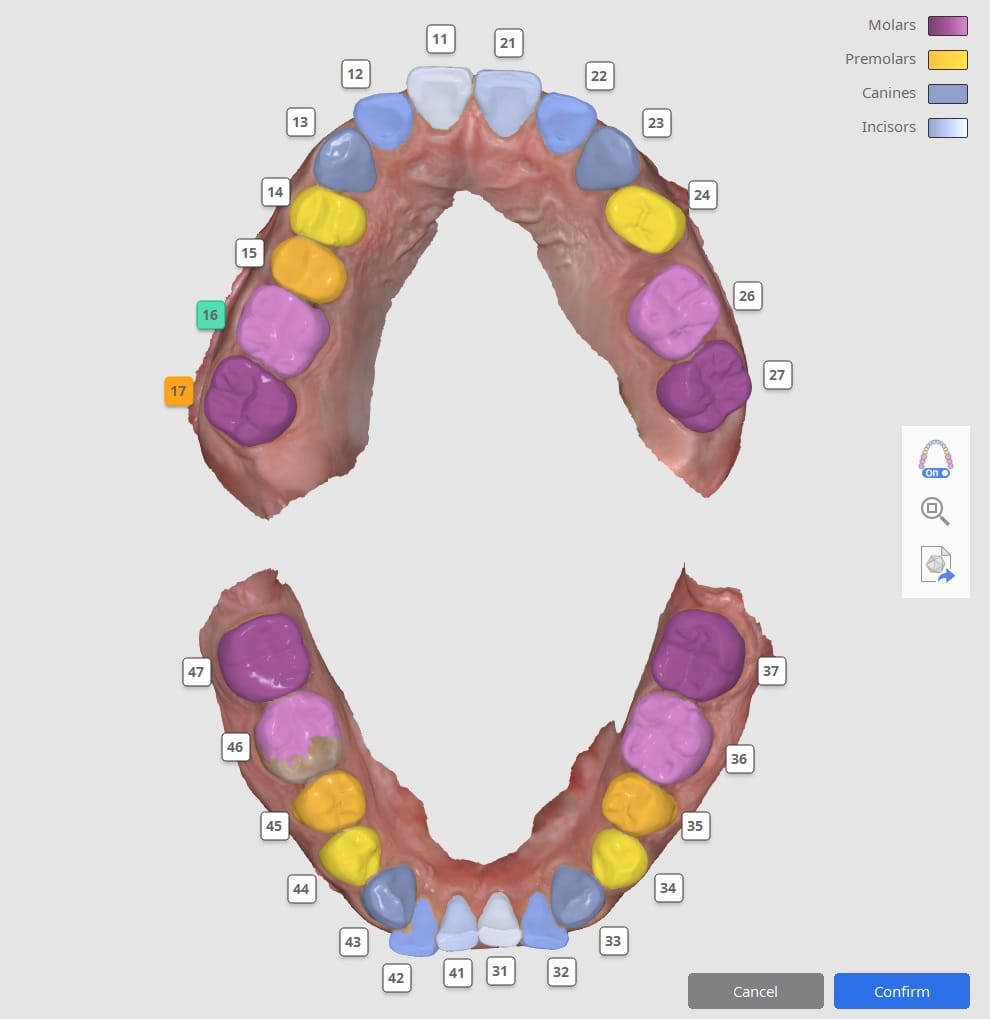 Segmenting Teeth Data.jpg