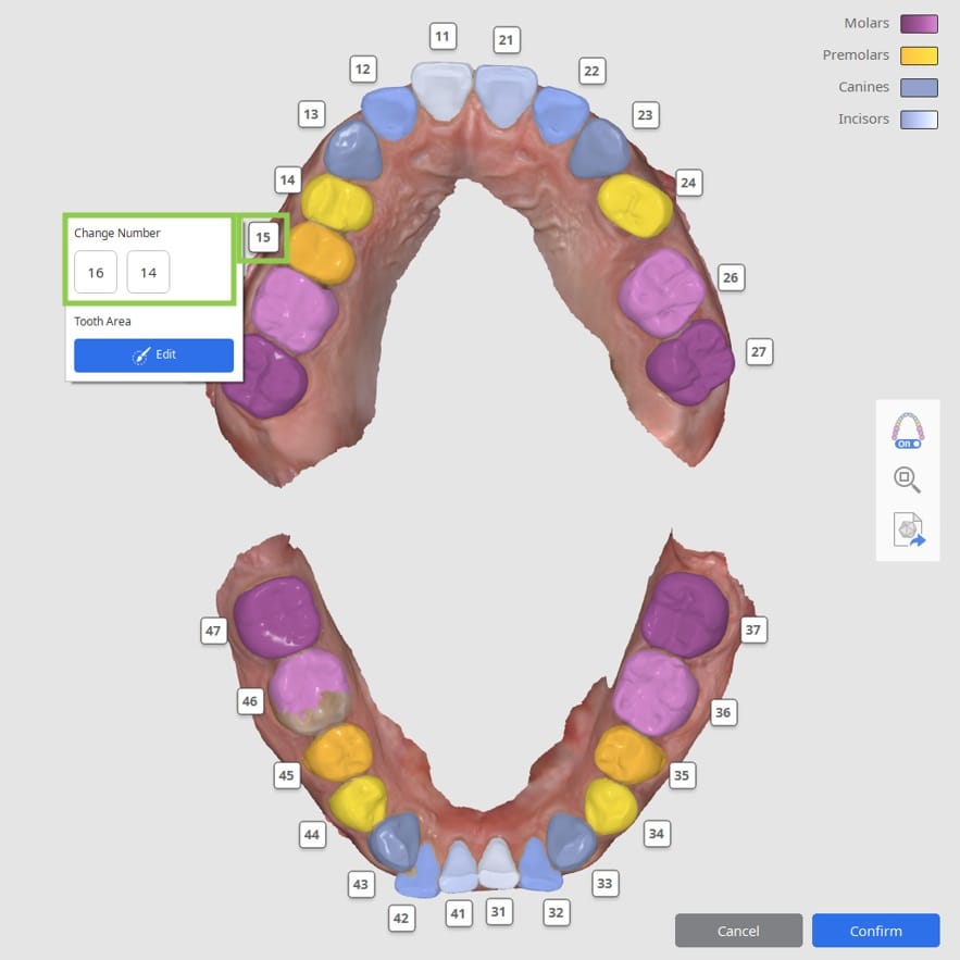 Segmenting Teeth Data 1.jpg