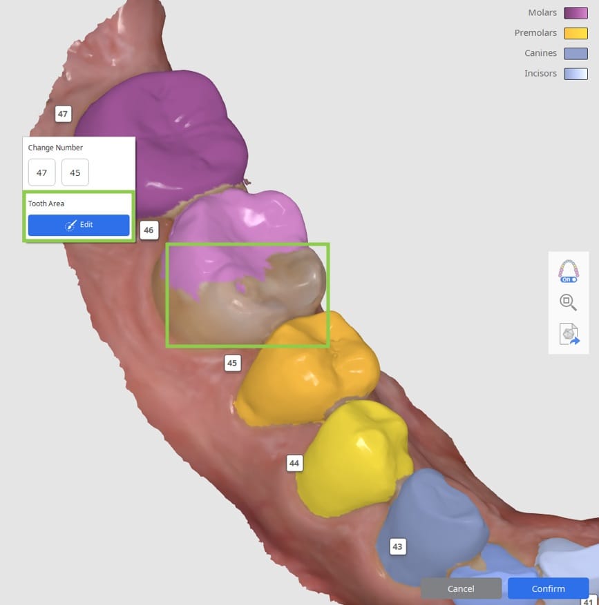 Segmenting Teeth Data 2.jpg