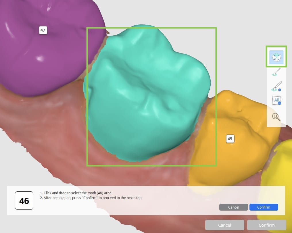 How to select tooth data.jpg