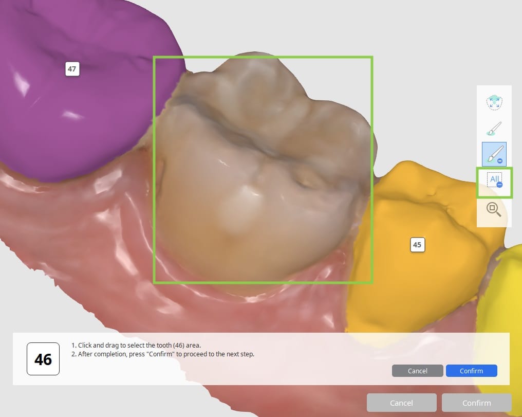 How to select tooth data 2.jpg