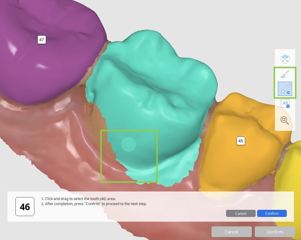 How to select tooth data 1.jpg