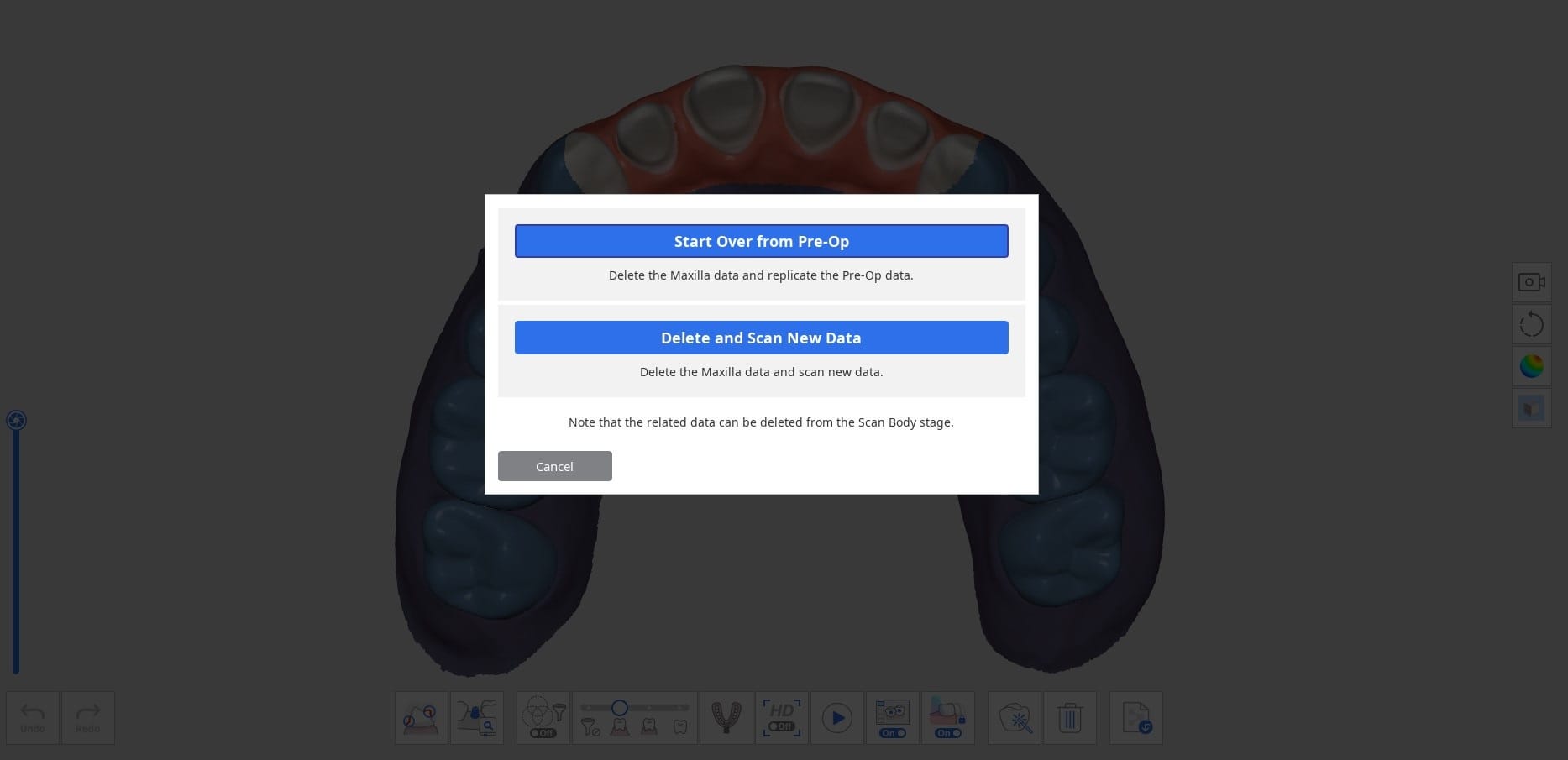 How to Delete Replicated Pre-Op Scan and Scan New Data-3.jpg