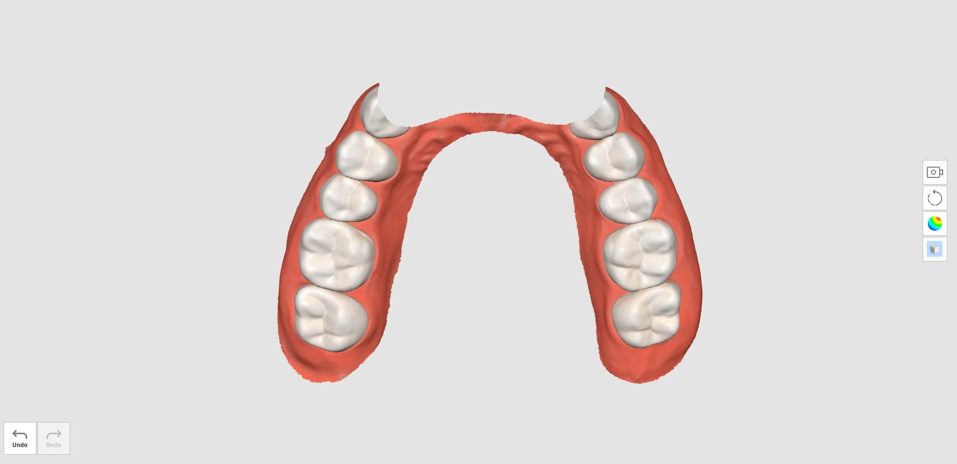 How to Utilize Pre-Op Scan With Trimming Tools-3.jpg