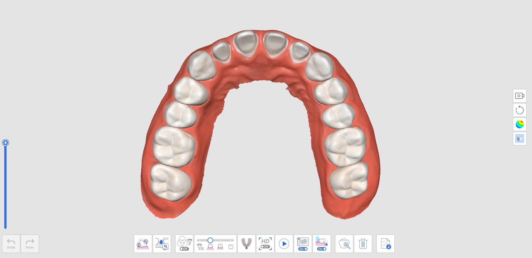 How to Utilize Pre-Op Scan-4.jpg