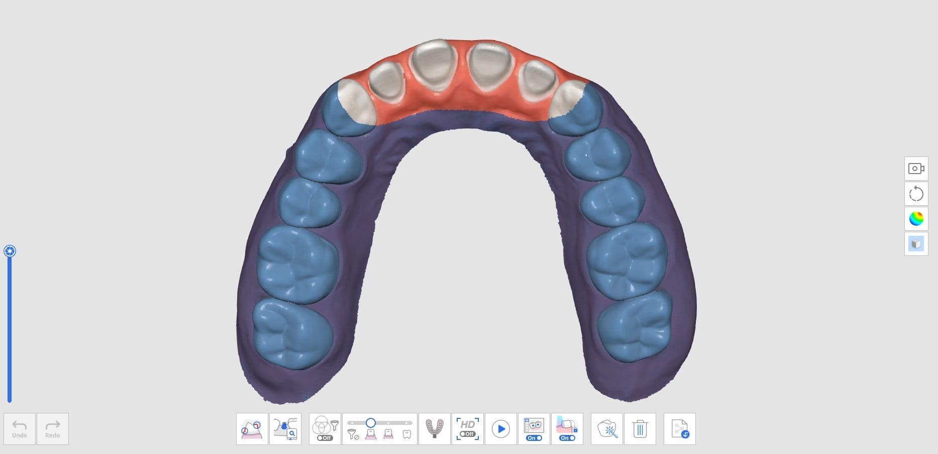 How to Delete Replicated Pre-Op Scan and Scan New Data-2.jpg