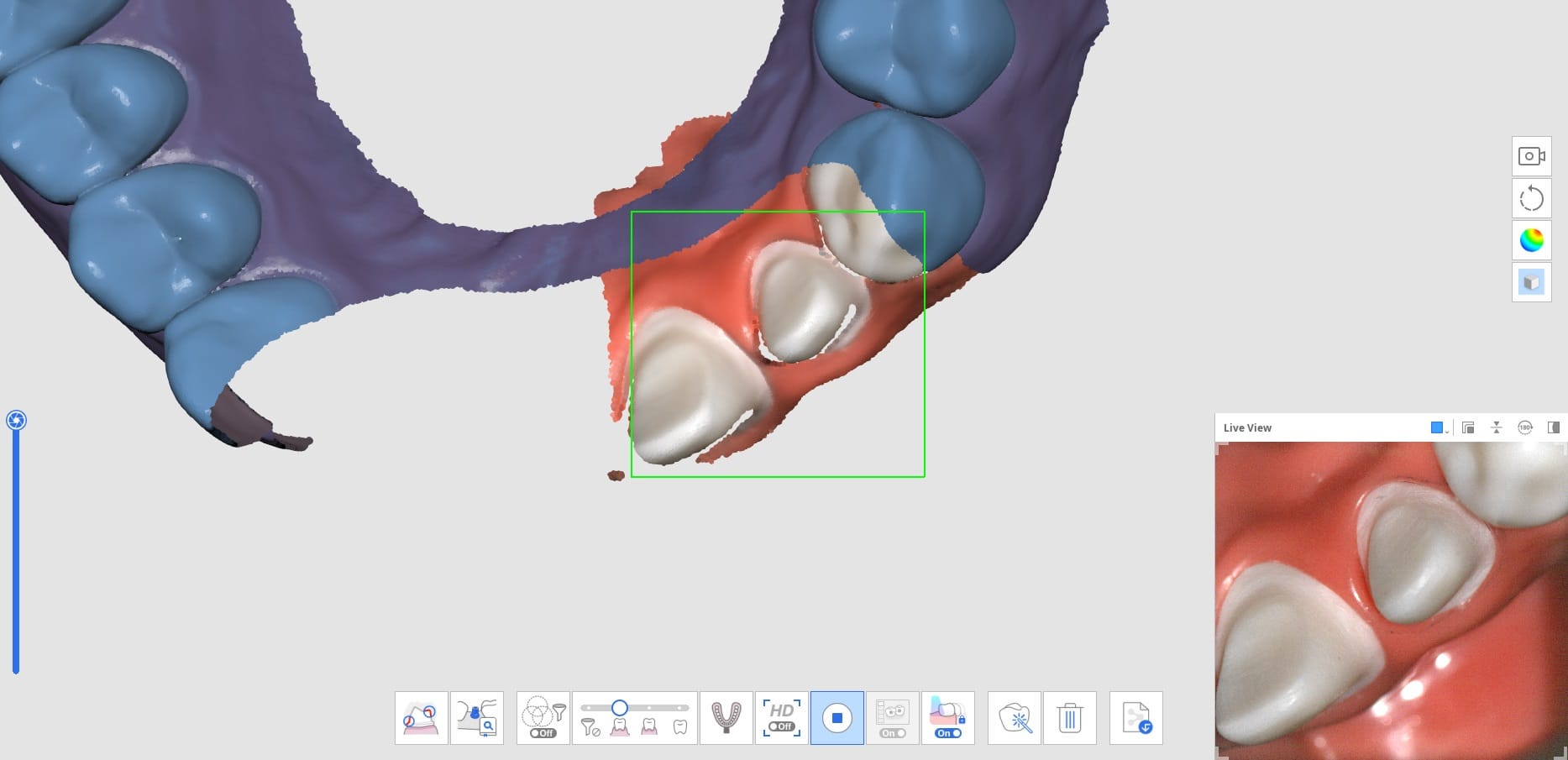 How to Utilize Pre-Op Scan With Trimming Tools-5.jpg