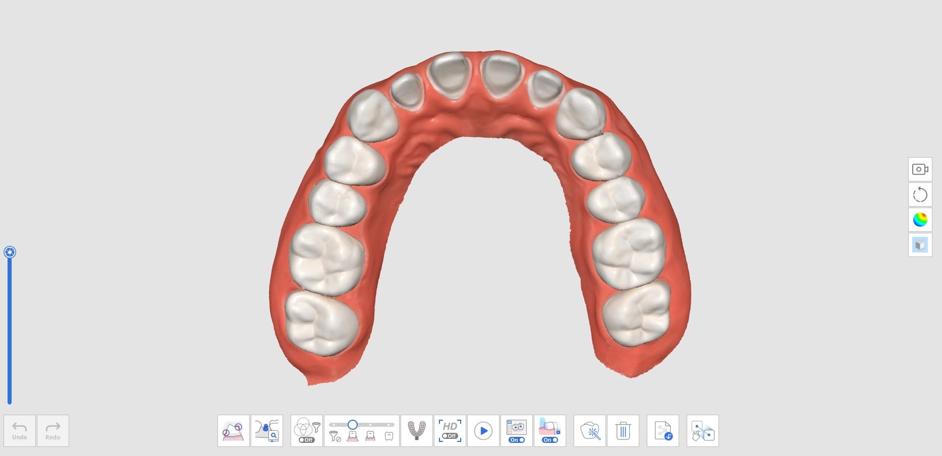 How to Delete Replicated Pre-Op Scan and Scan New Data-6.jpg