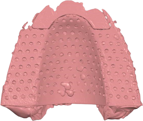 Metal-mode_0000_Metal-impression-tray.png