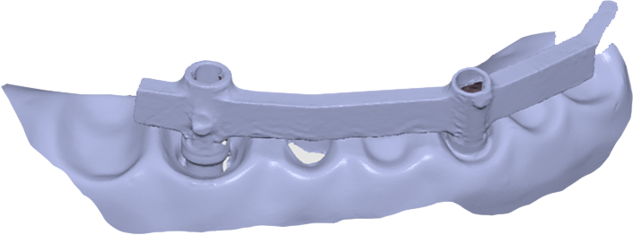 Metal-mode_0001_Metal-mode-off.png