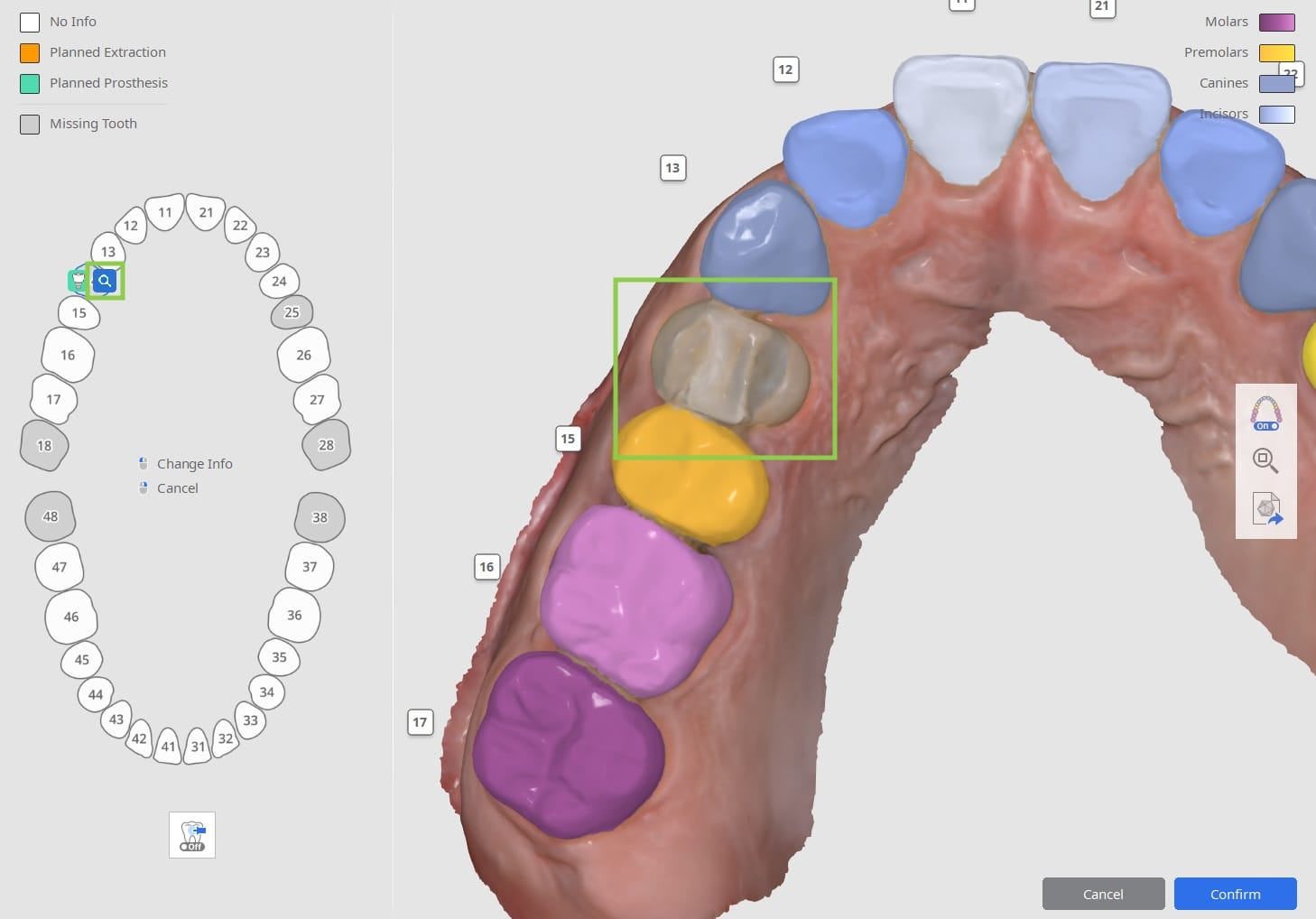 Segmenting Teeth Data 3.jpg