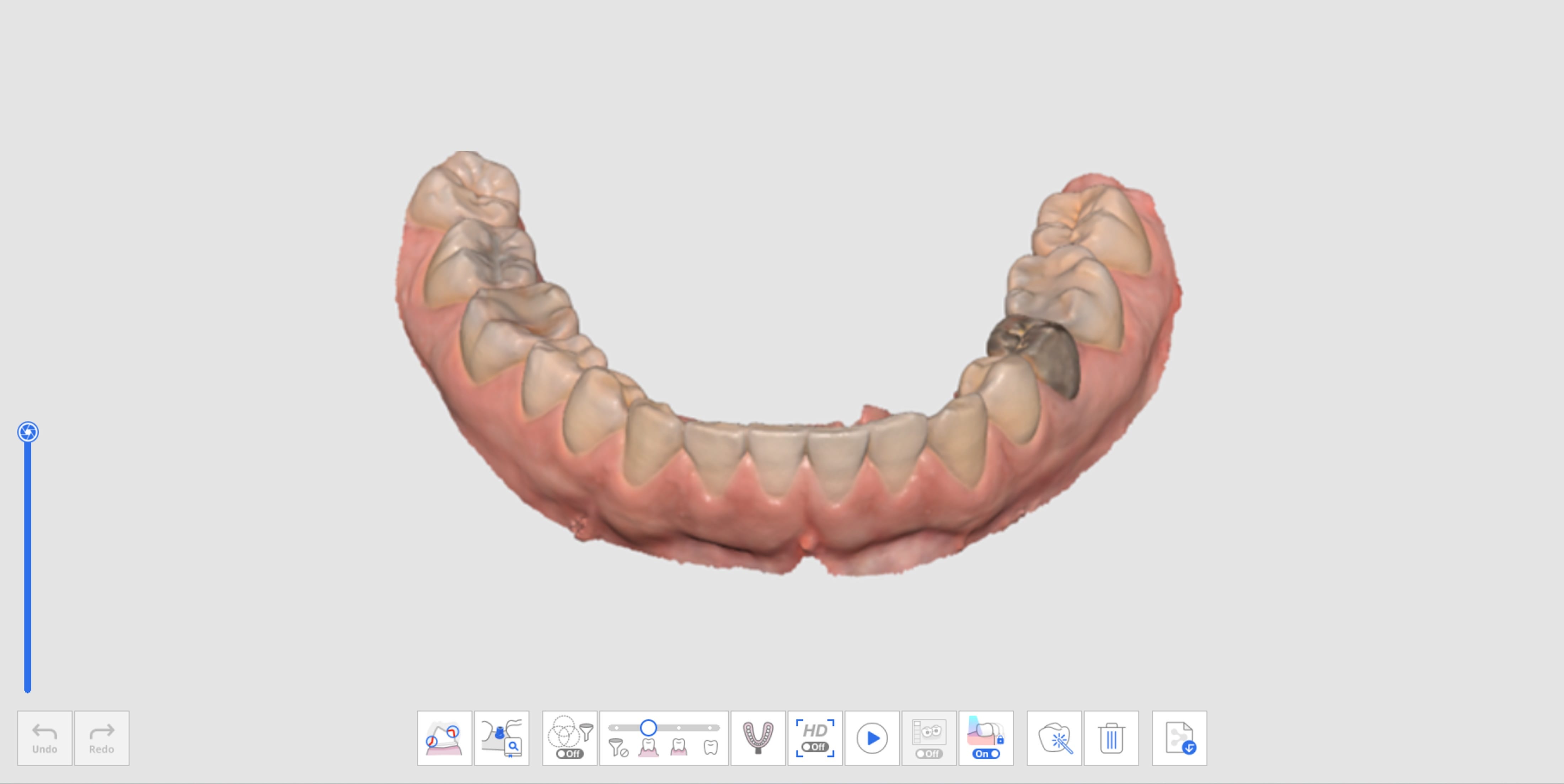 Mandible Stage.jpg