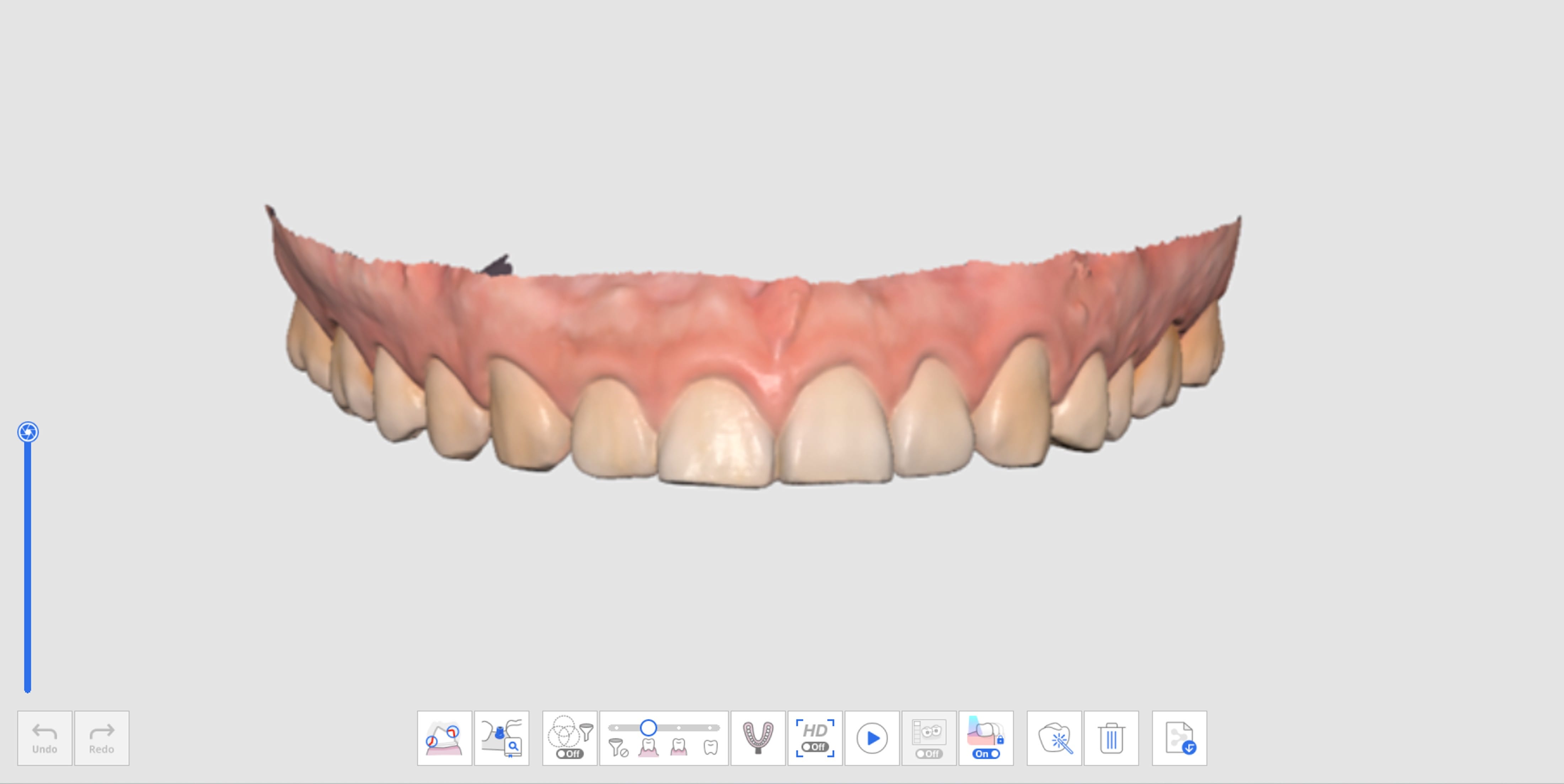 Maxilla Stage.jpg