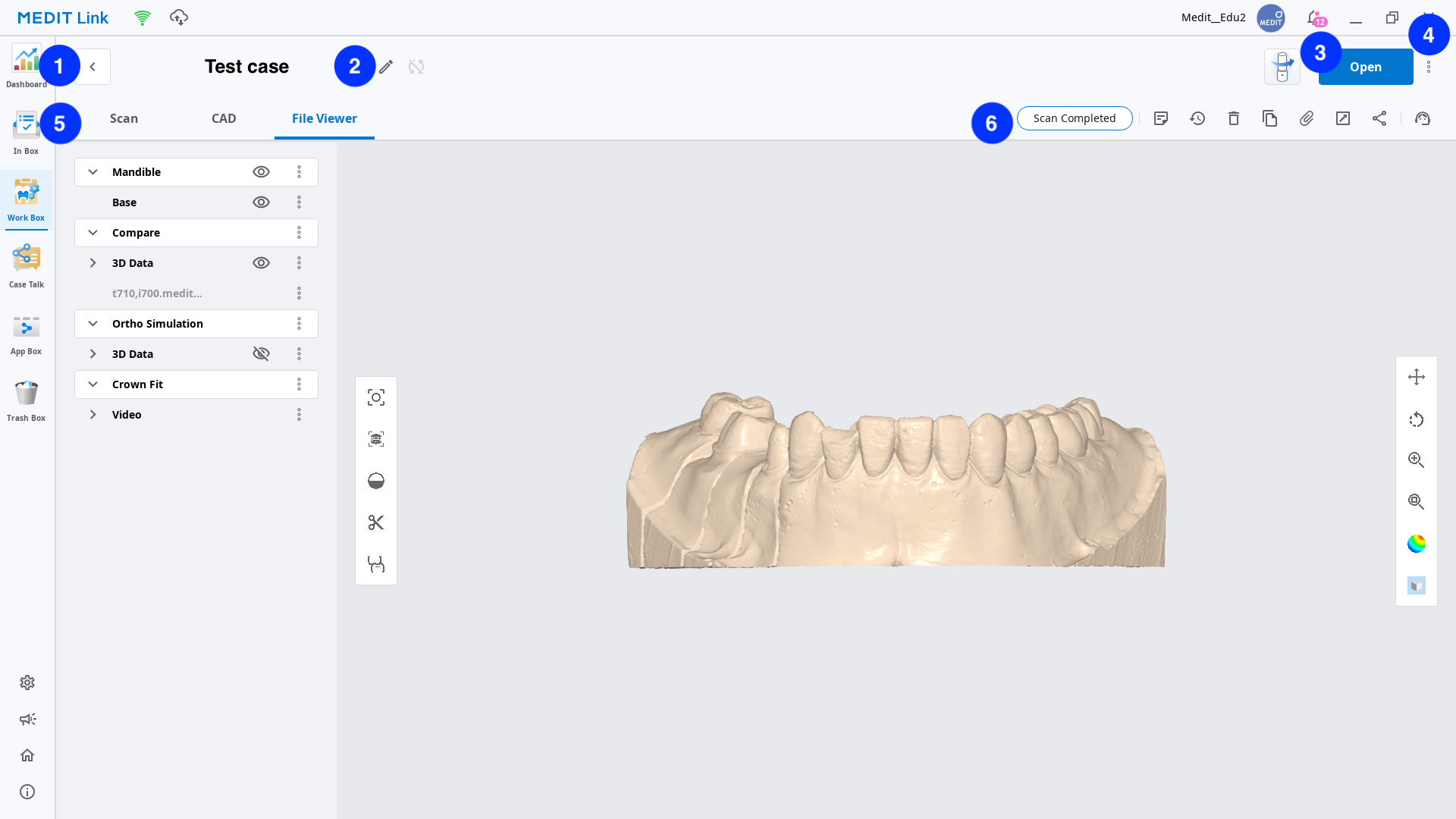2.5.7_work_detail.png