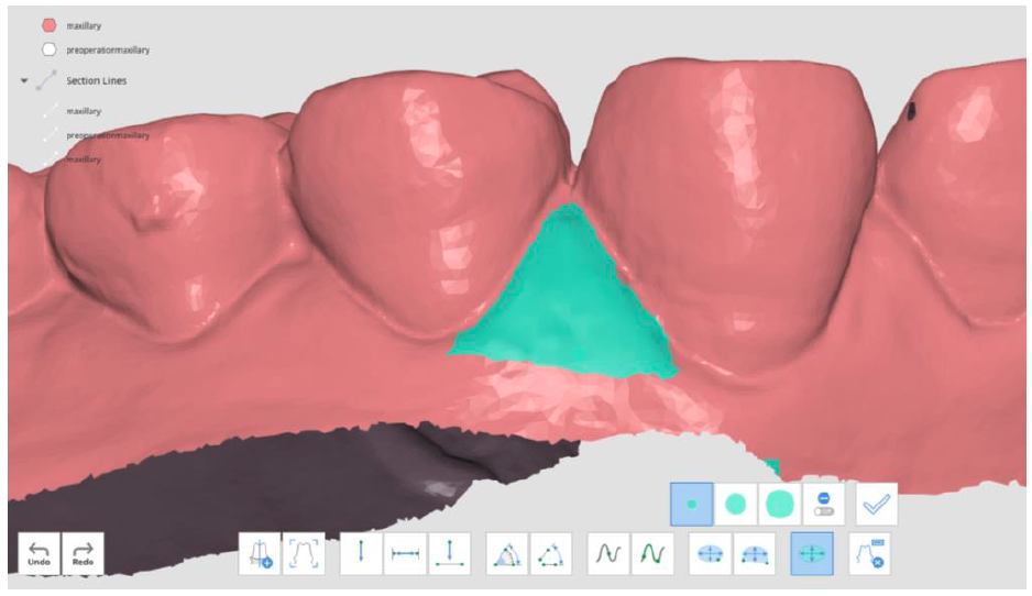 measure_area_1.png