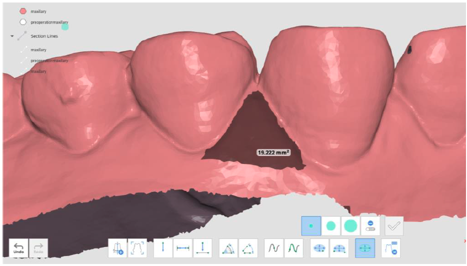 measure_area_2.png