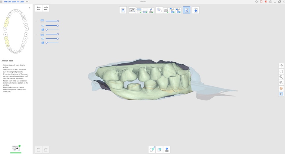 Impression Scan for Occlusion 6.jpg